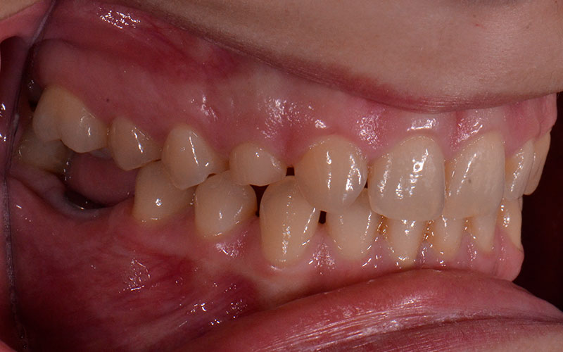 Before-Δείγμα 2